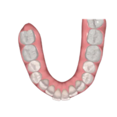 Illustration of teeth suited to Invisalign Lite Invisalign treatment