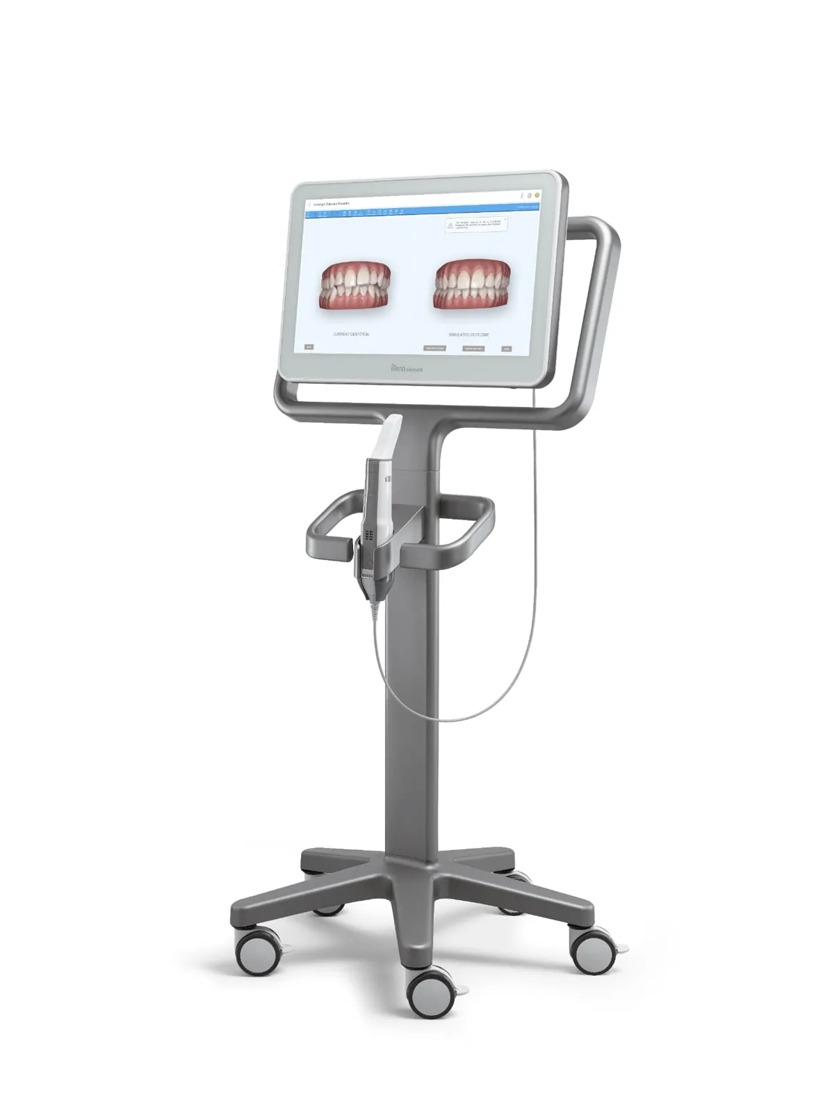 iTero digital scanner used at J&R Dental for a no-impressions Invisalign consultation.
